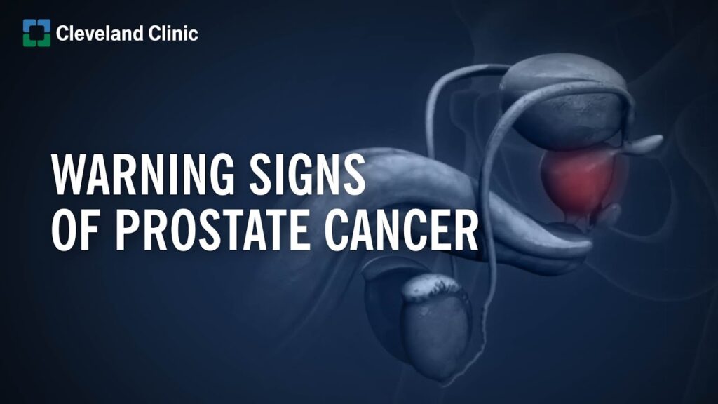 Promoting Early Detection: The Key to Improving Prostate Cancer Outcomes
