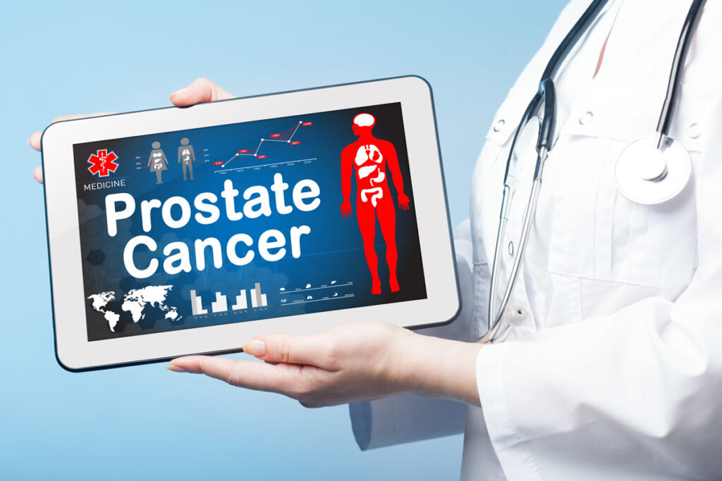 Emerging Technologies for Prostate Cancer Detection